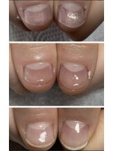 スターネイル(Starnail)/深爪さんの育成