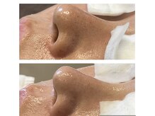 カンナム小顔 海老名店/