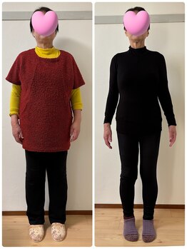 リノリコ 千葉船橋(Lino Liko)/ビフォーアフター（60代女性）