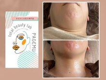 ページミュー/スッキリしませんか？