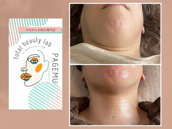 ページミュー/スッキリしませんか？