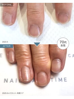 ネイルケアタイム メディカルセンター川越店(NAIL CARE TiME)/通って良かったネイルケアサロン