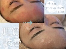 アマテラススキンラウンジ(Amatelas SKIN LOUNGE)