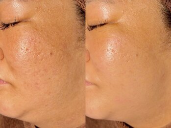 ルーナジェーナ(Luna llena)/池袋 エステ ルーナジェーナ