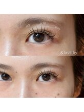 ウイ(u`iii)/＆ヘルシー/バインドロック100束