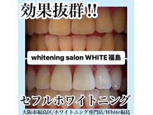 ホワイトニングサロン ホワイト(WHITE)/セルフホワイトニング/大阪/福島