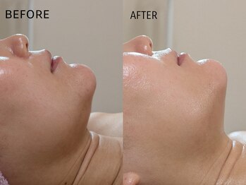 シャリル(charire)/フェイラインスッキリ♪