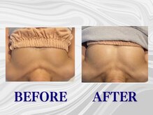 ザモア 福岡天神(THE MORE)/【症例 Before After】