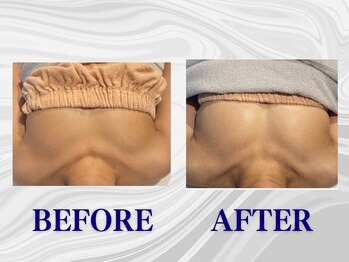 ザモア 福岡天神(THE MORE)/【症例 Before After】