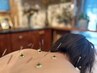 【　リピート多数　】お悩みに寄り添う鍼灸＆全身ケア60分