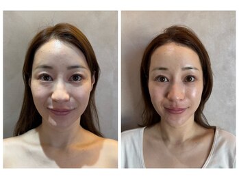 ナルシス(Narcissus)/大切な前の日のスペシャルケア