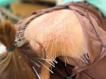 もりさわ治療院 与力町治療室  トサカ(TOSAKA)