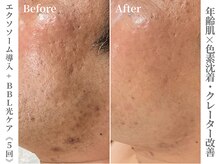 ゼアー(THERE FY.)