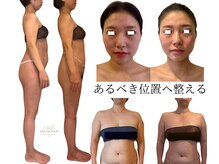 エミナル(EMINALu)の雰囲気（ビフォア1回/リフトアップ/二重顎/食いしばり/たるみケア/小顔）