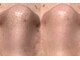 ルイス(LOUIS)の写真/黒ずみ・開き毛穴改善◎韓国式毛穴洗浄でつるんたまご肌へ