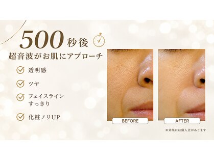 コスメ アンド エステ おぬきの写真