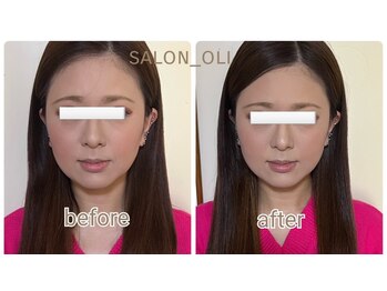 サロン オリ(salon_oli)/エデマソリューションリフト