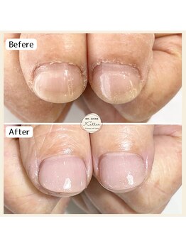 自爪育成　再来