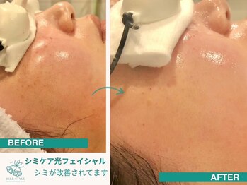 ベルスタイル(Bell style)/当店のお客様症例