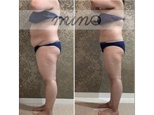 ミノ 美里大通り店(mino)/ダイエットパッケージ