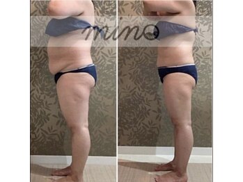 ミノ 美里大通り店(mino)/ダイエットパッケージ