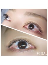 ヴィダ(VIDA)/【つけ放題】まつ毛エクステ