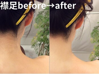 ももとゆでたまご/うなじビフォーアフター/新宿