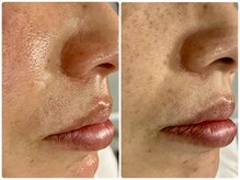 リアン(Lien)の雰囲気（フェイシャルWAXでツヤ肌を手に入れませんか？毛穴の汚れまで◎）