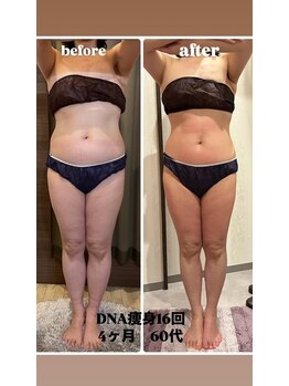 エステサロン ベリシモ(Bellissimo)/痩身/ビフォーアフター