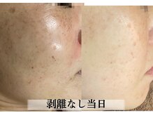 ラビエス(LAVIES)/【40代】肌の手入れなんて・・・