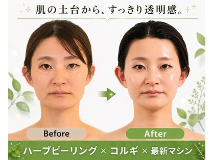 チェイル(JEIL)の写真