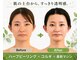 チェイル(JEIL)の写真