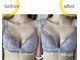 ラジュワード(lajward)の写真/【1度の施術でここまで溢れる】もっちり、本来の位置に♪ワンサイズアップでふわふわバストへ
