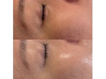 アイリーボーテ 東大阪(アイリーBEAUTE)の雰囲気（50代/目まわりのこじわ/ツヤ【JR/近鉄俊徳道駅】）