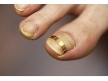 爪切り屋 足楽 日本橋三越前店/【OP】スパンゲ