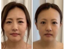 美人バスト 岡崎店/理想のお顔に！