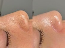 ルーナジェーナ(Luna llena)/池袋　エステ　ルーナジェーナ