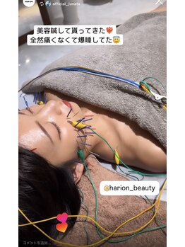 ハリオン 中目黒(HARI-ON)/#美容鍼