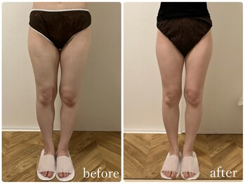 リリィブラン(Lily branc)/痩身/ヒップ+太もも集中