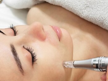 サロンM 豊田店の写真/新感覚の【肌質改善ソフトダーマ7980円】お肌の表面をやさしく整え、つるんと柔らかい質感へ導きます♪