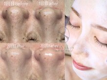 ソアスキン(SOAskin)の雰囲気（【潤い溢れるハリつや肌へ】韓国ララピール◎ララピール公認♪）