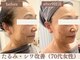 スリーエッセンス(3THREE ESSENCE)の写真/【幹細胞エクソソーム美容で本格エイジングケア】初回￥8000～年齢による様々な、お悩みを根本から解決へ！