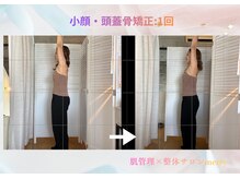 メリー 大和西大寺店(merry)/小顔・頭蓋骨矯正Before after★