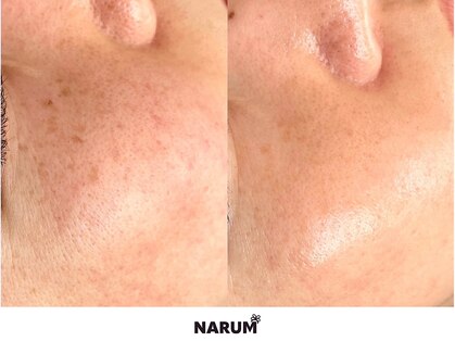 ナルムフェイシャル 代々木(NARUM facial)の写真