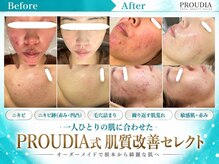 プラウディア(PROUDIA)