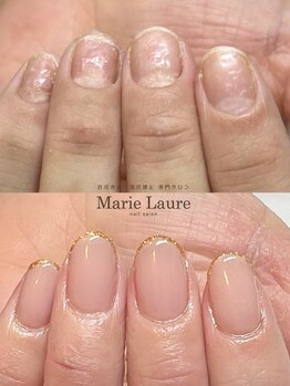 マリーロール 梅田店(Marie Laure)/自爪育成/深爪矯正/ネイルケア