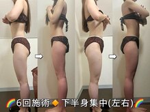 サロンドココ(Salon de COCO)/ハイパーナイフ/下半身痩身/美脚