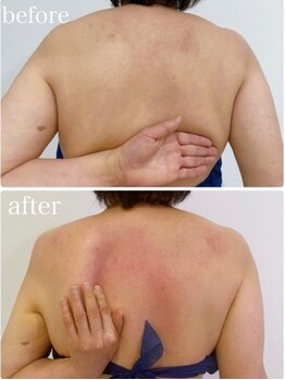 ハクカスパ(HAKUKA SPA)/60代のお客様☆