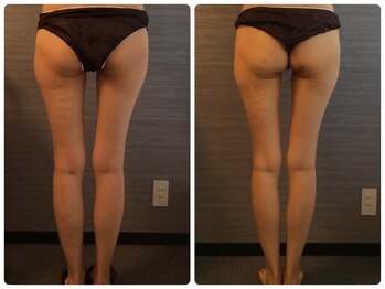 美容整体 ウェリナ 蟹江院/小顔矯正/骨盤矯正/美脚サロン