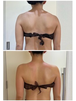 エイシスグロウ(asis glow.)/効果写真